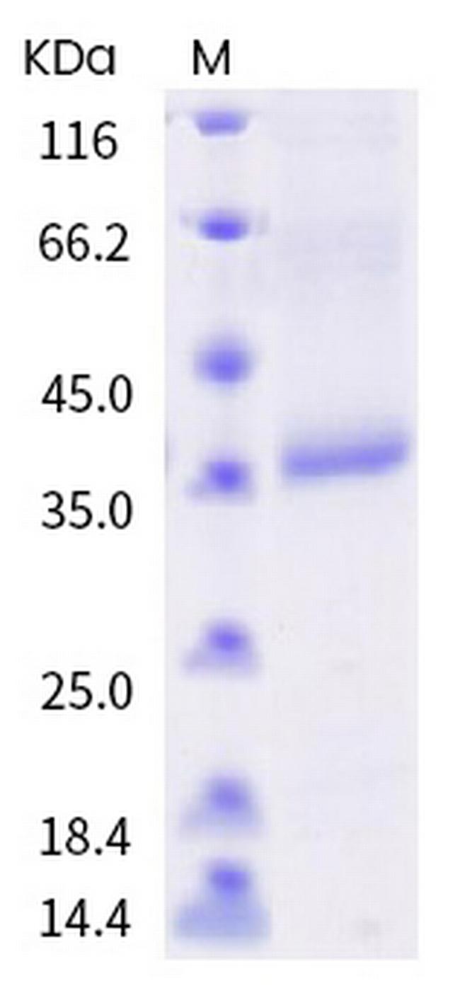 SARS-CoV-2 Spike Protein (RBD) (K458Q) His-tag Protein