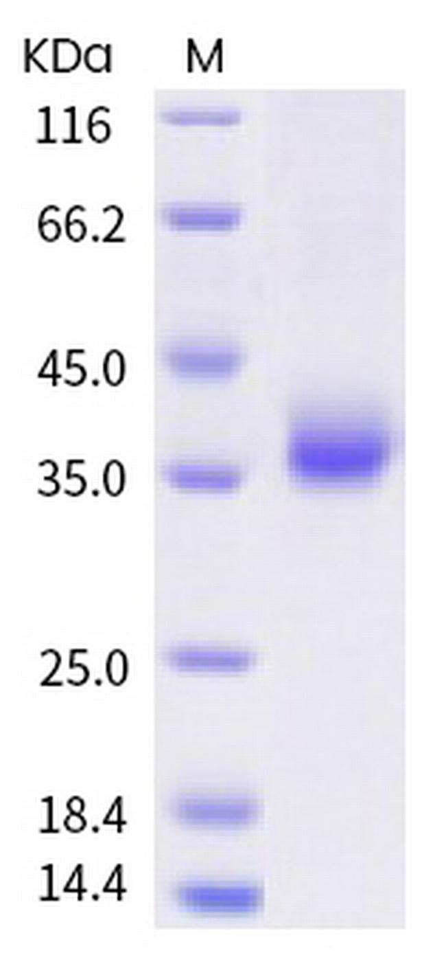SARS-CoV-2 Spike Protein (RBD) (L452R) His-tag Protein