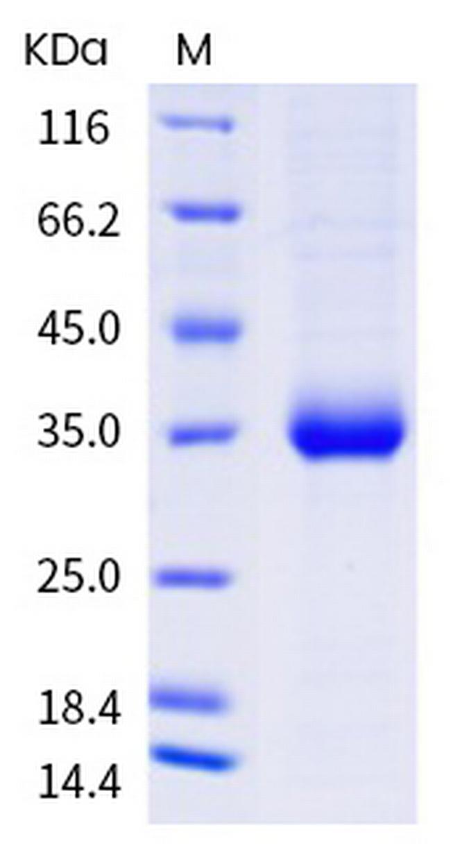SARS-CoV-2 Spike Protein (RBD) (L455F) His-tag Protein