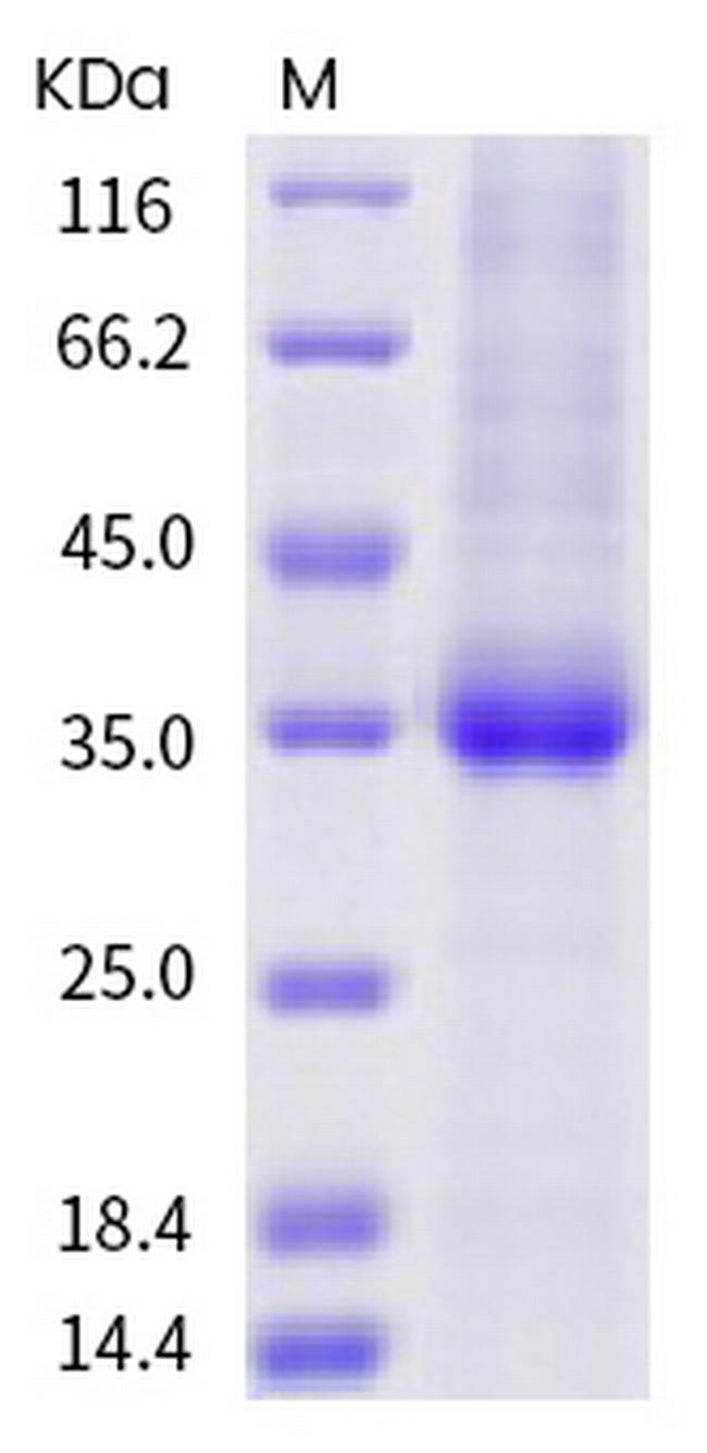 SARS-CoV-2 Spike Protein (RBD) (N370S) His-tag Protein