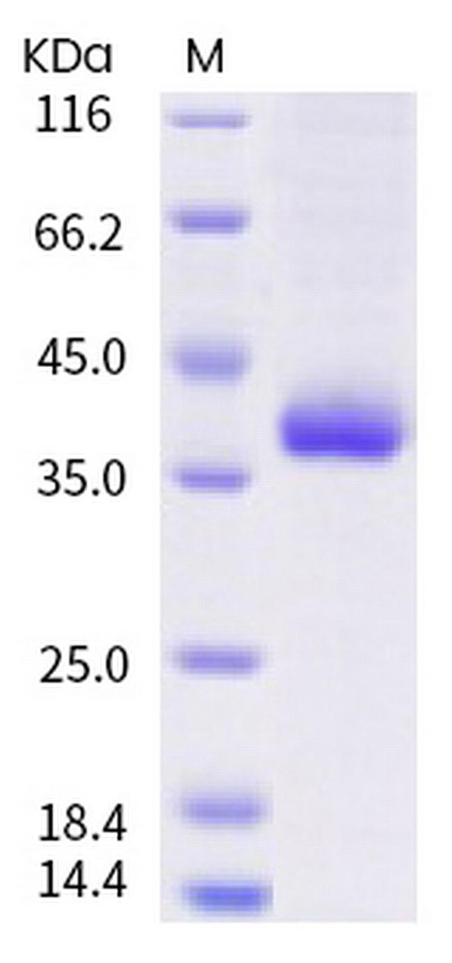 SARS-CoV-2 Spike Protein (RBD) (N439K) His-tag Protein
