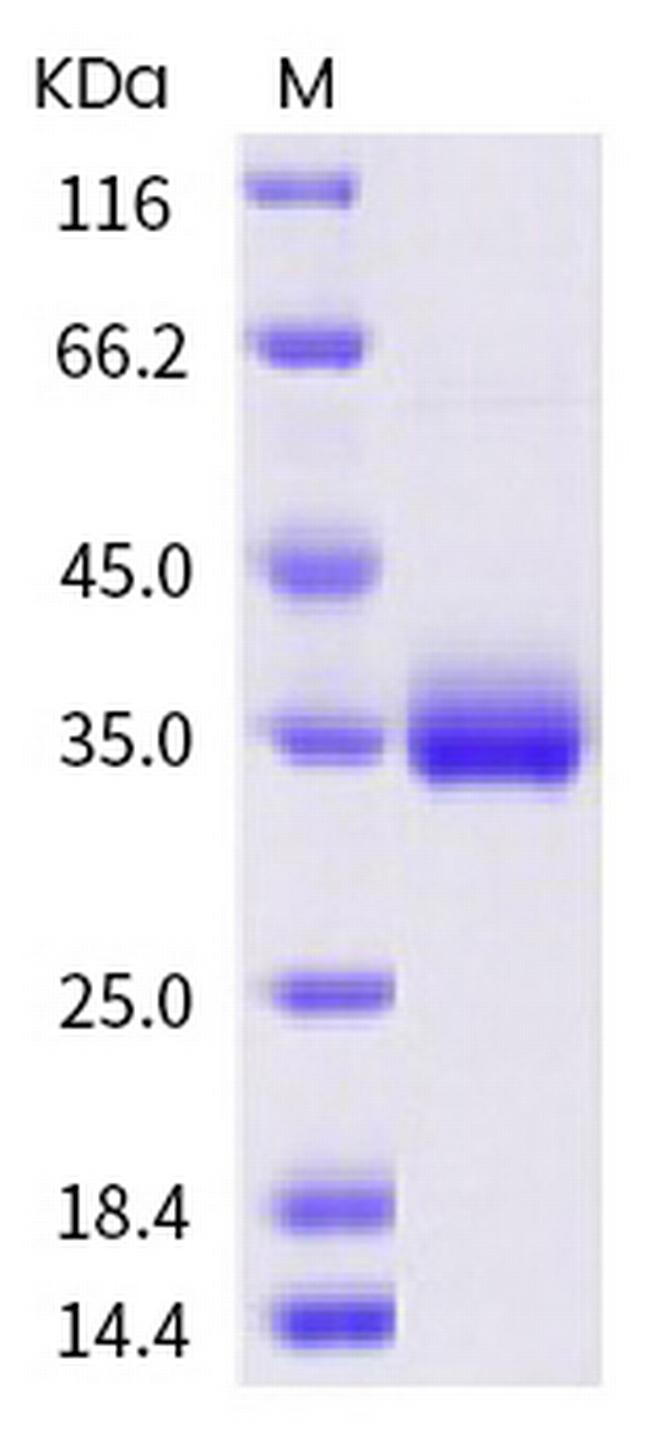 SARS-CoV-2 Spike Protein (RBD) (N440K) His-tag Protein