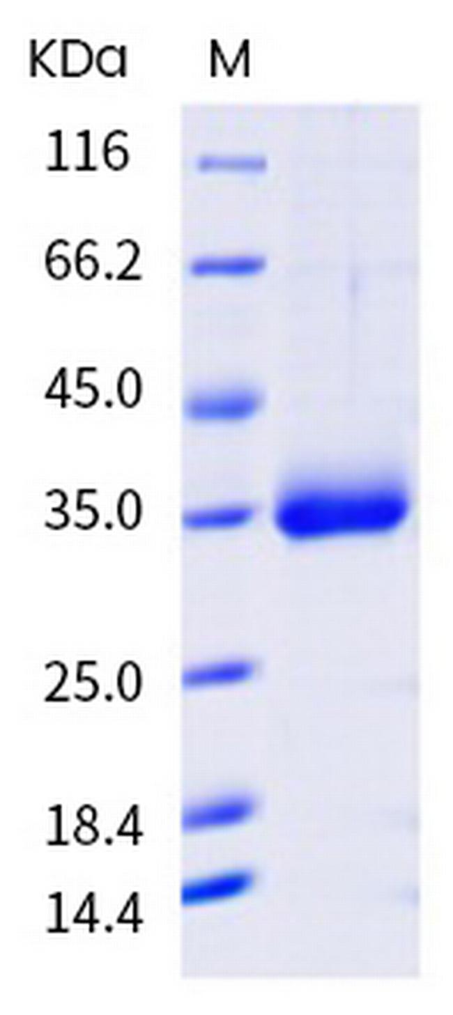SARS-CoV-2 Spike Protein (RBD) (N487R) His-tag Protein