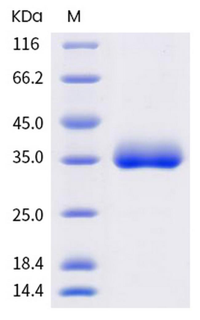 SARS-CoV-2 Spike Protein (RBD) (N501Y) His-tag Protein