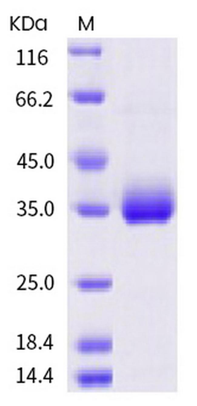 SARS-CoV-2 Spike Protein (RBD) (P337S) His-tag Protein