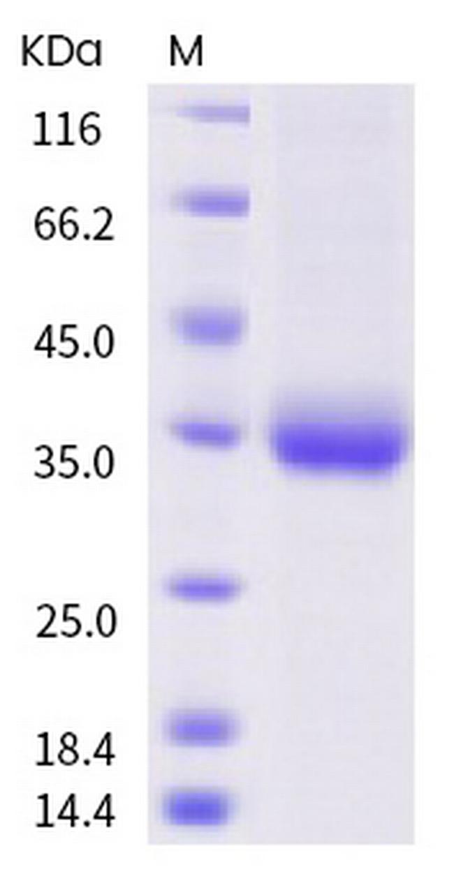 SARS-CoV-2 Spike Protein (RBD) (P384L) His-tag Protein