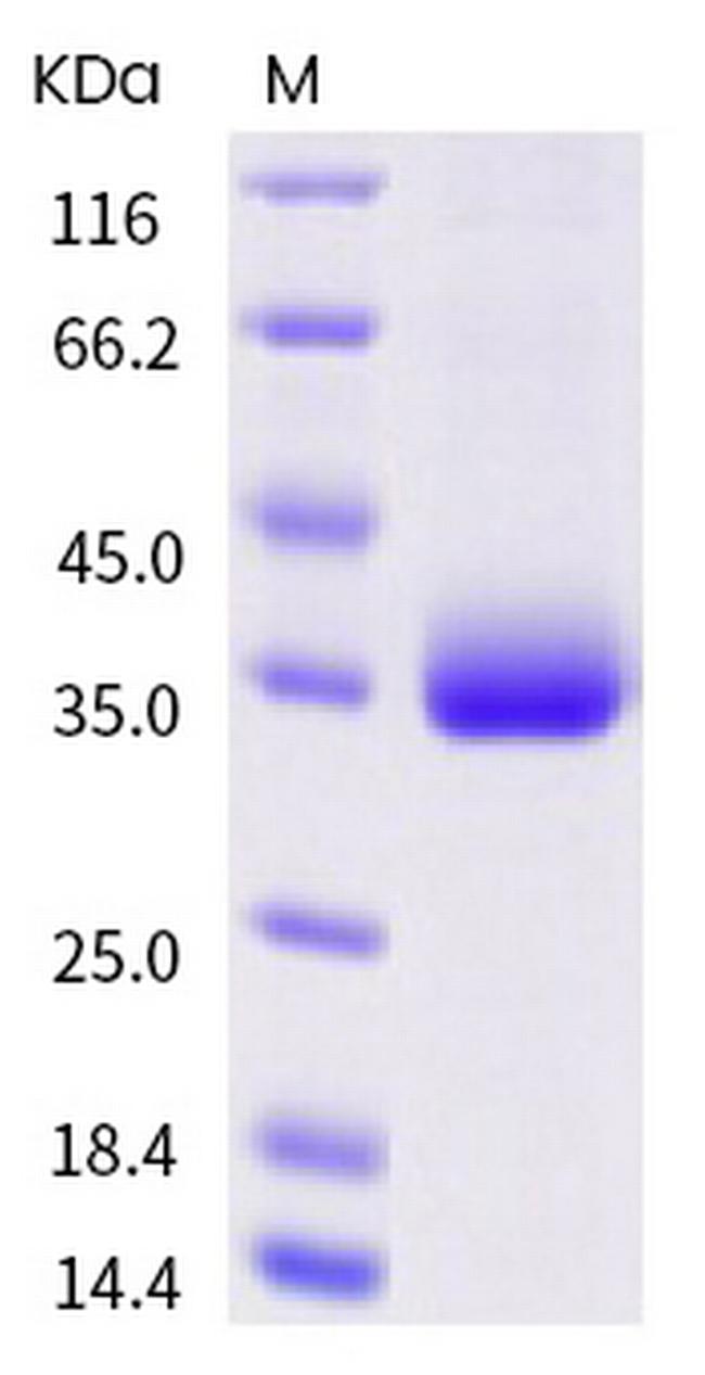 SARS-CoV-2 Spike Protein (RBD) (P479S) His-tag Protein
