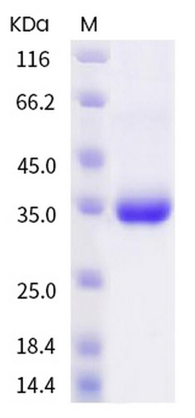 SARS-CoV-2 Spike Protein (RBD) (P499R) His-tag Protein