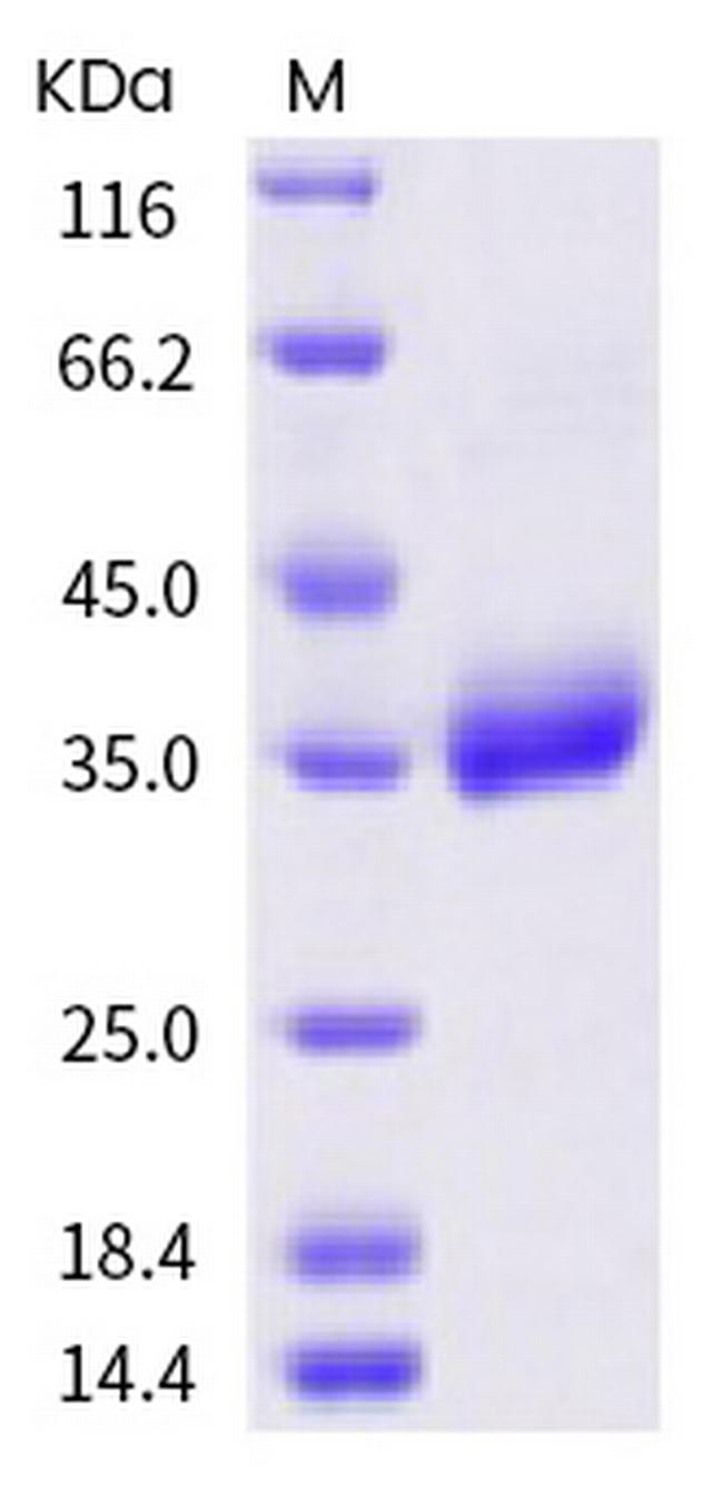 SARS-CoV-2 Spike Protein (RBD) (P521R) His-tag Protein