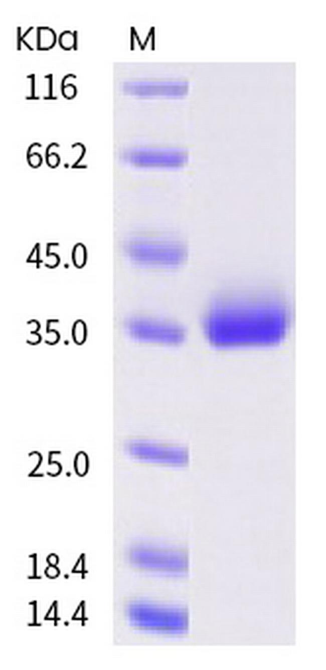 SARS-CoV-2 Spike Protein (RBD) (P521S) His-tag Protein