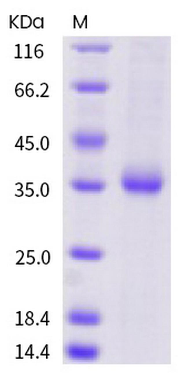 SARS-CoV-2 Spike Protein (RBD) (Q409E) His-tag Protein