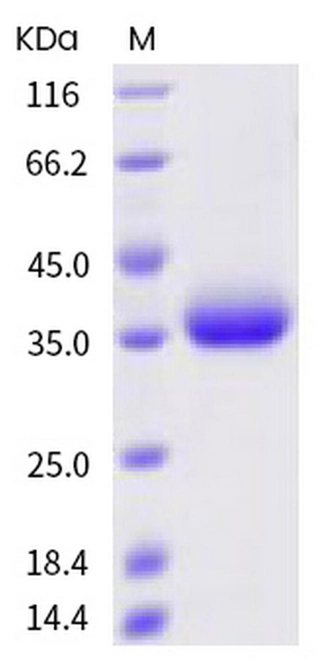 SARS-CoV-2 Spike Protein (RBD) (Q414R) His-tag Protein