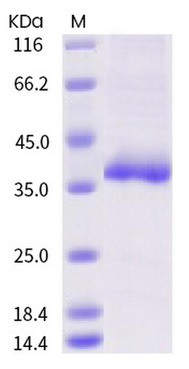 SARS-CoV-2 Spike Protein (RBD) (R408I) His-tag Protein