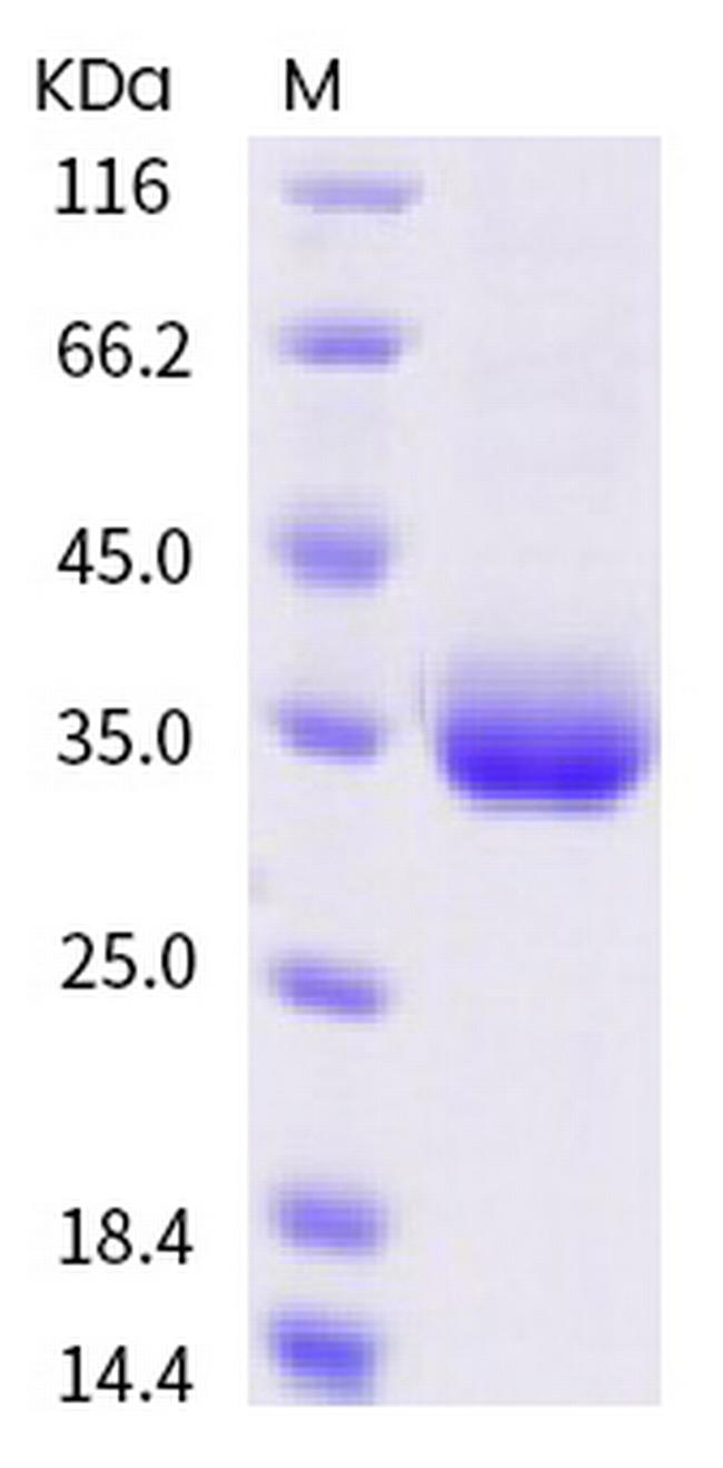 SARS-CoV-2 Spike Protein (RBD) (S359N) His-tag Protein