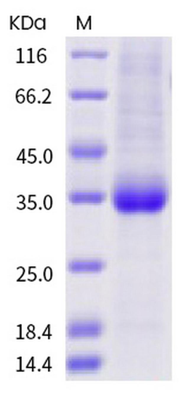SARS-CoV-2 Spike Protein (RBD) (S477I) His-tag Protein