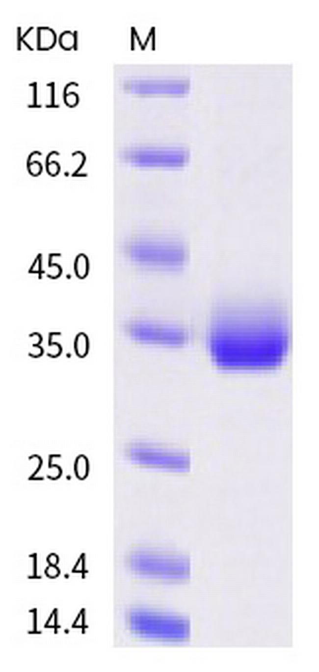 SARS-CoV-2 Spike Protein (RBD) (S477N) His-tag Protein