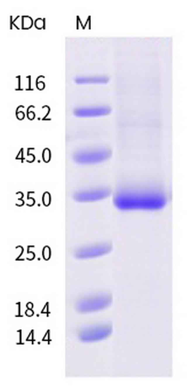 SARS-CoV-2 Spike Protein (RBD) (S477R) His-tag Protein