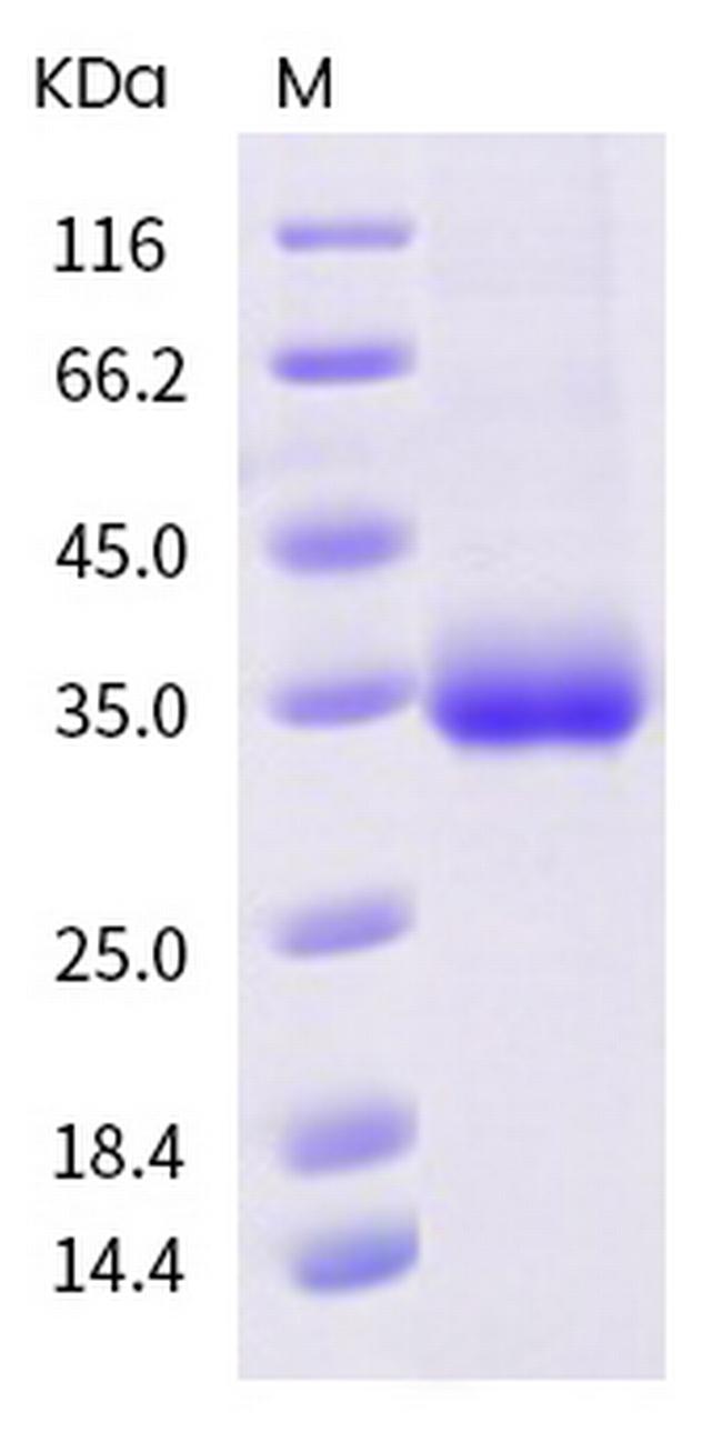 SARS-CoV-2 Spike Protein (RBD) (S494P) His-tag Protein