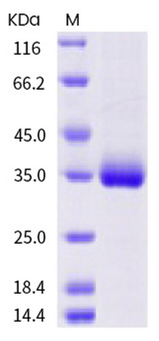 SARS-CoV-2 Spike Protein (RBD) (T393P) His-tag Protein
