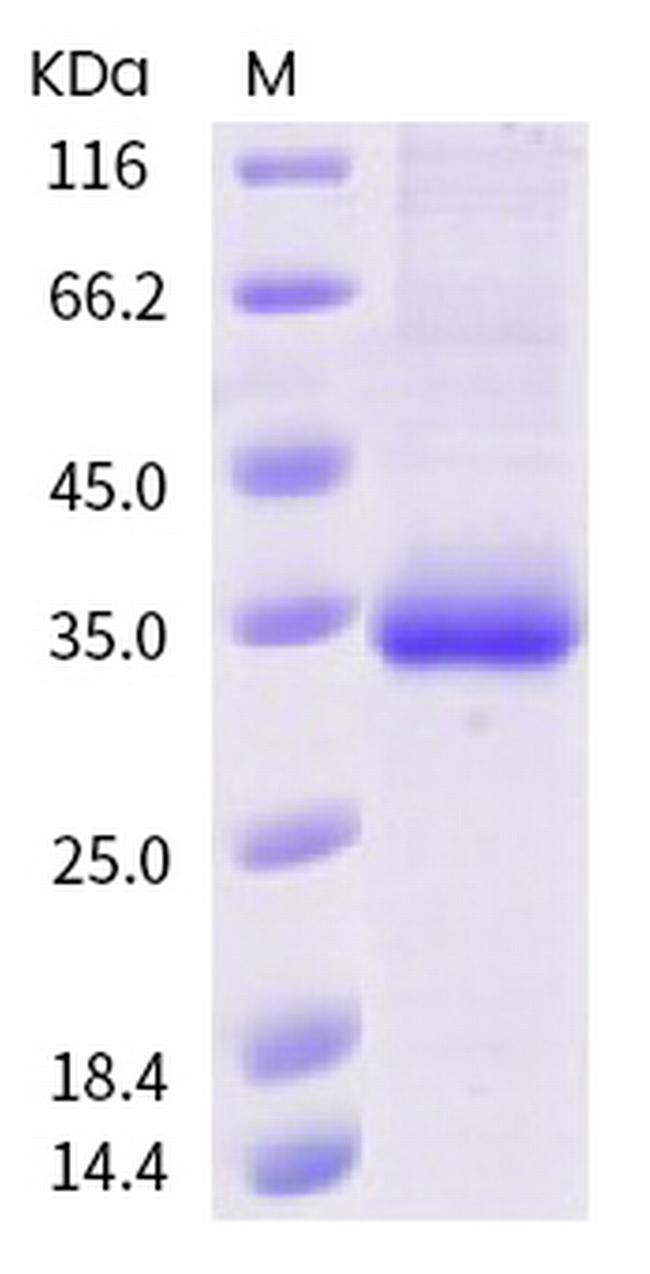 SARS-CoV-2 Spike Protein (RBD) (T478I) His-tag Protein