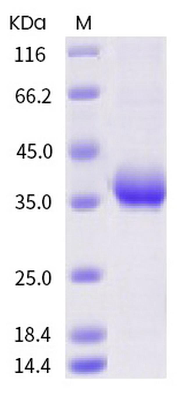 SARS-CoV-2 Spike Protein (RBD) (V341I) His-tag Protein