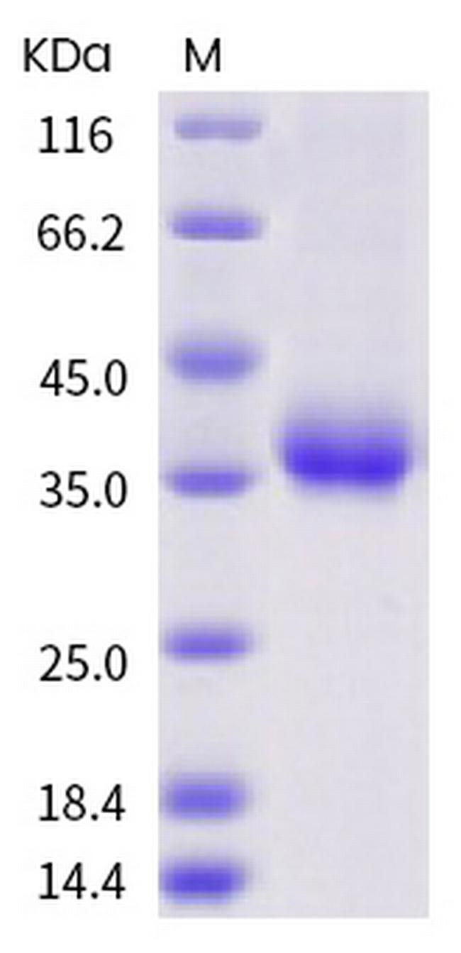 SARS-CoV-2 Spike Protein (RBD) (V395I) His-tag Protein