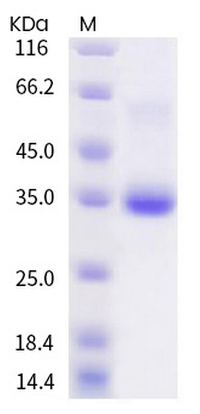 SARS-CoV-2 Spike Protein (RBD) (V445F) His-tag Protein