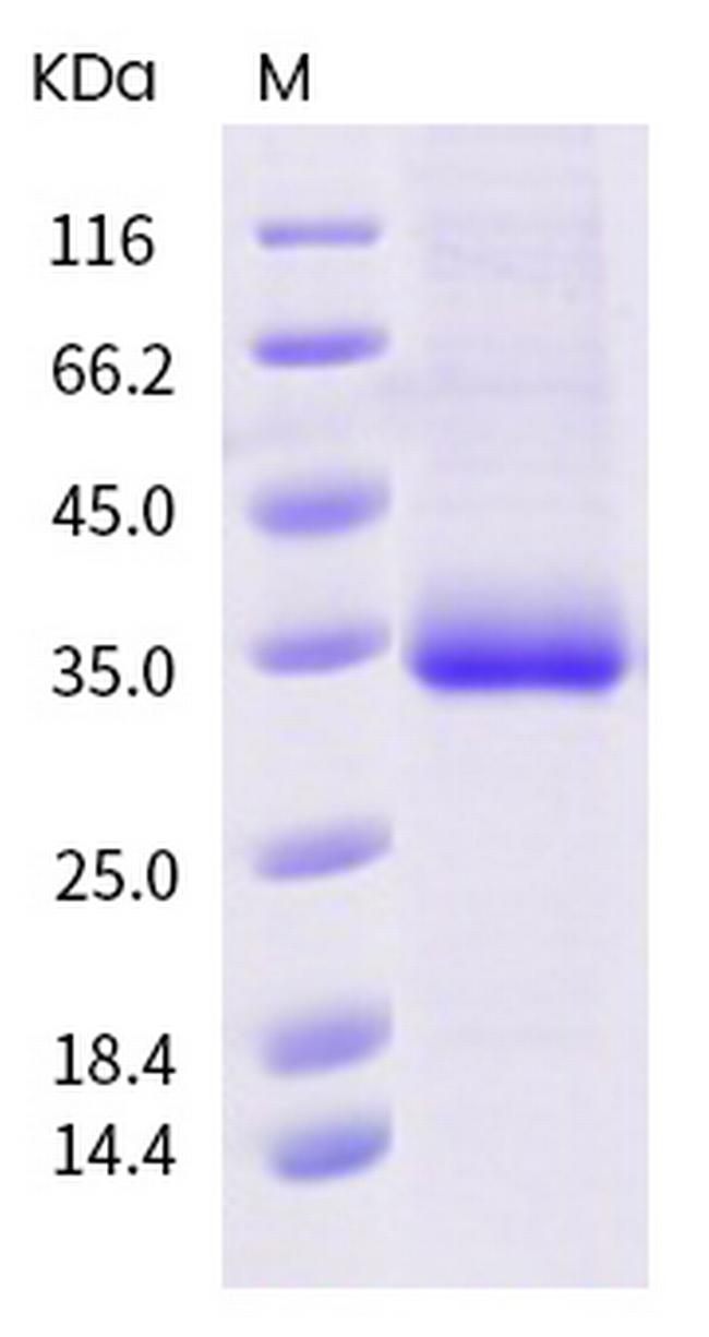 SARS-CoV-2 Spike Protein (RBD) (V483I) His-tag Protein