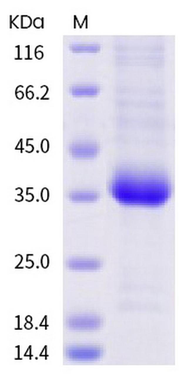 SARS-CoV-2 Spike Protein (RBD) (V503F) His-tag Protein