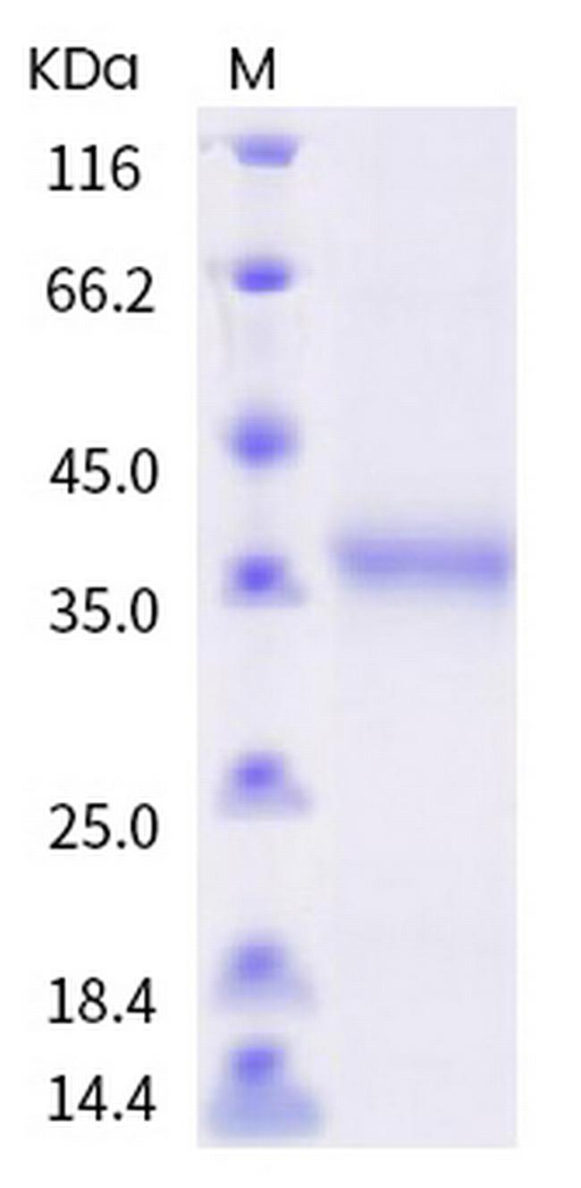 SARS-CoV-2 Spike Protein (RBD) (Y505C) His-tag Protein