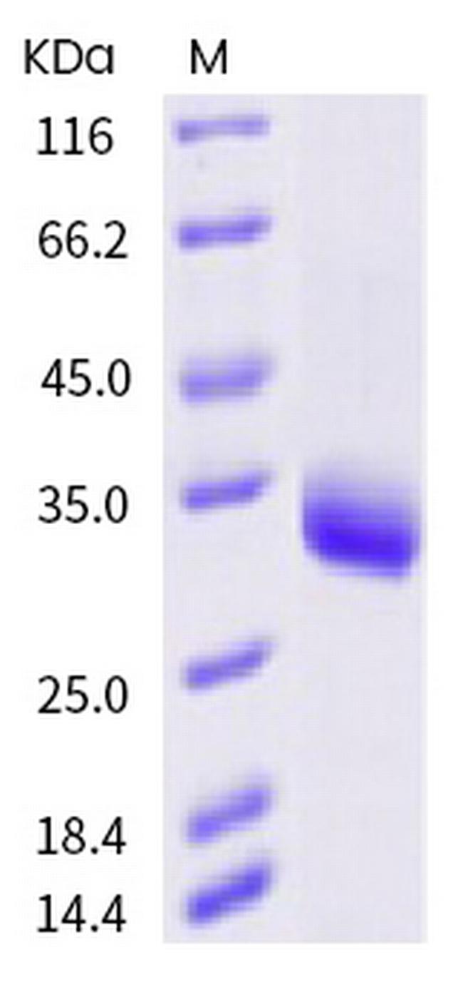 SARS-CoV-2 Spike Protein (RBD) (Y508H) His-tag Protein