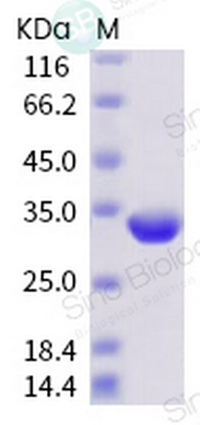 SARS-CoV-2 Spike Protein (RBD) His-Avi Tag Protein