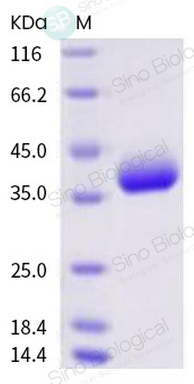 SARS-CoV-2 Spike Protein (RBD) His-Avi Tag Protein