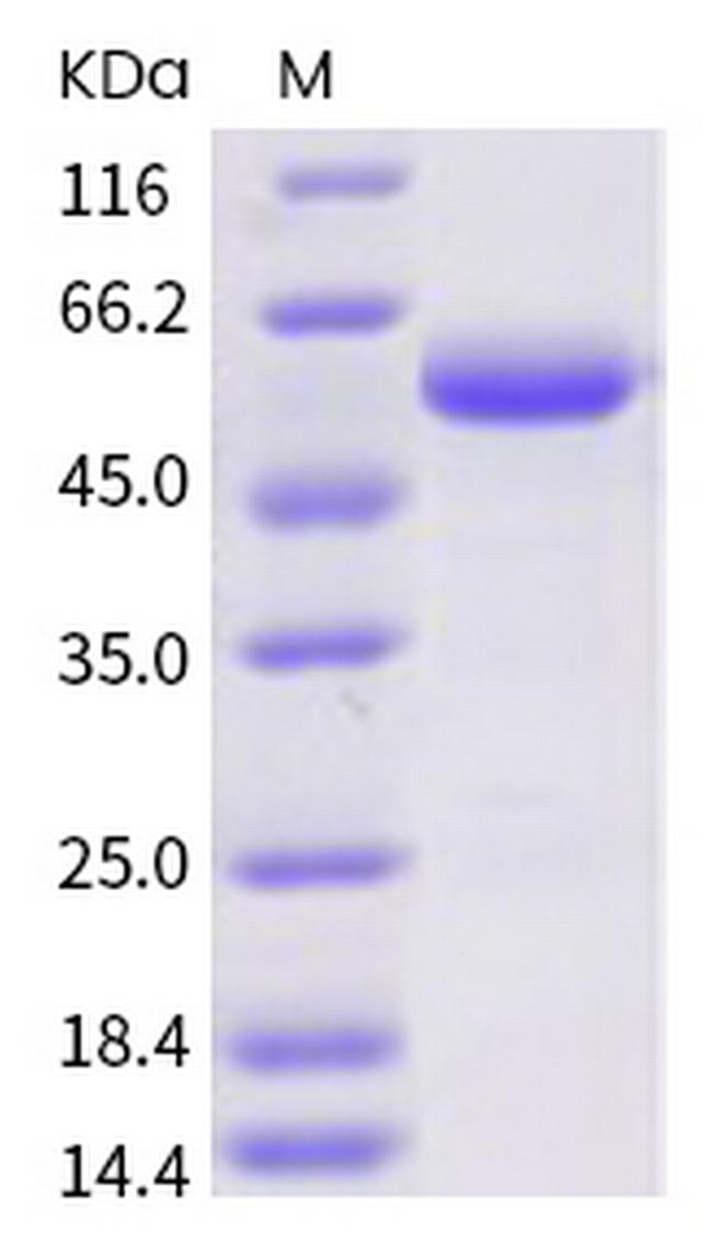 SARS-CoV-2 Spike Protein (RBD) Fc Chimera Protein