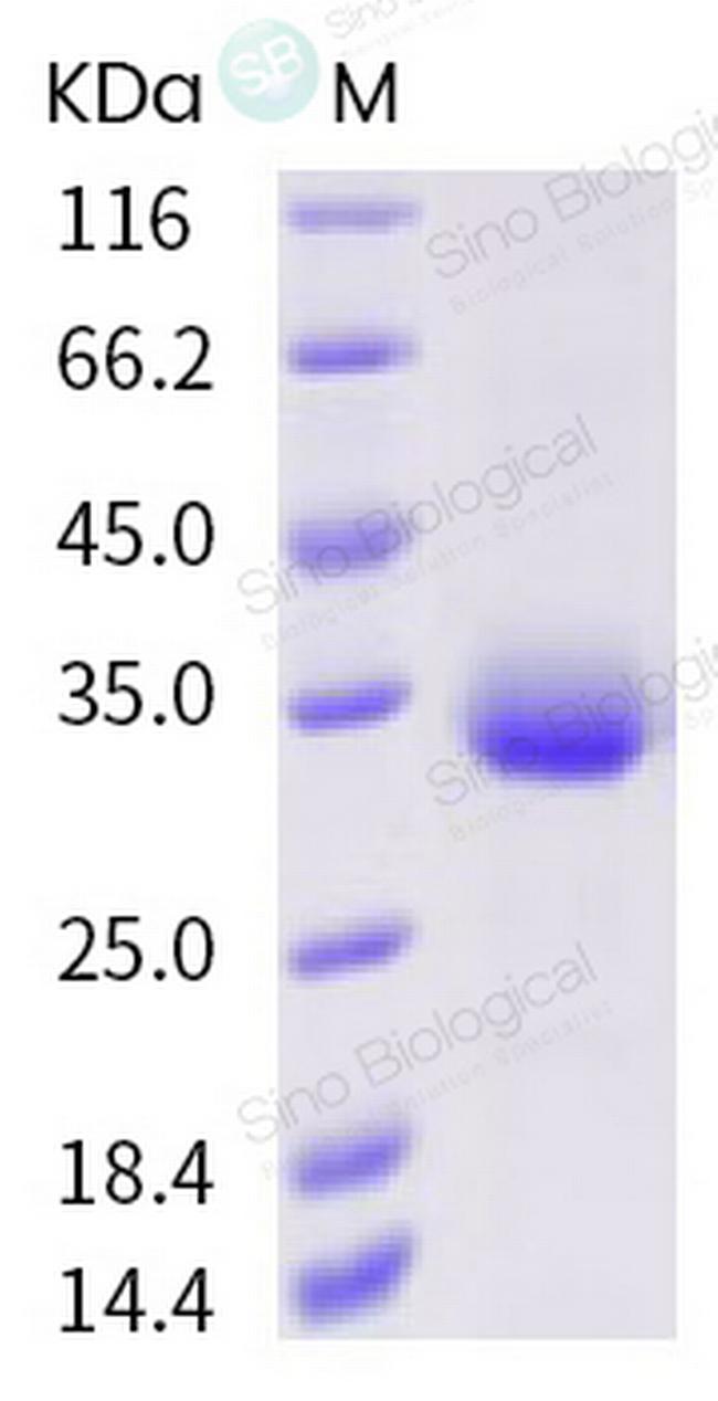 SARS-CoV-2 Spike Protein (RBD) (A435S) His-tag Protein