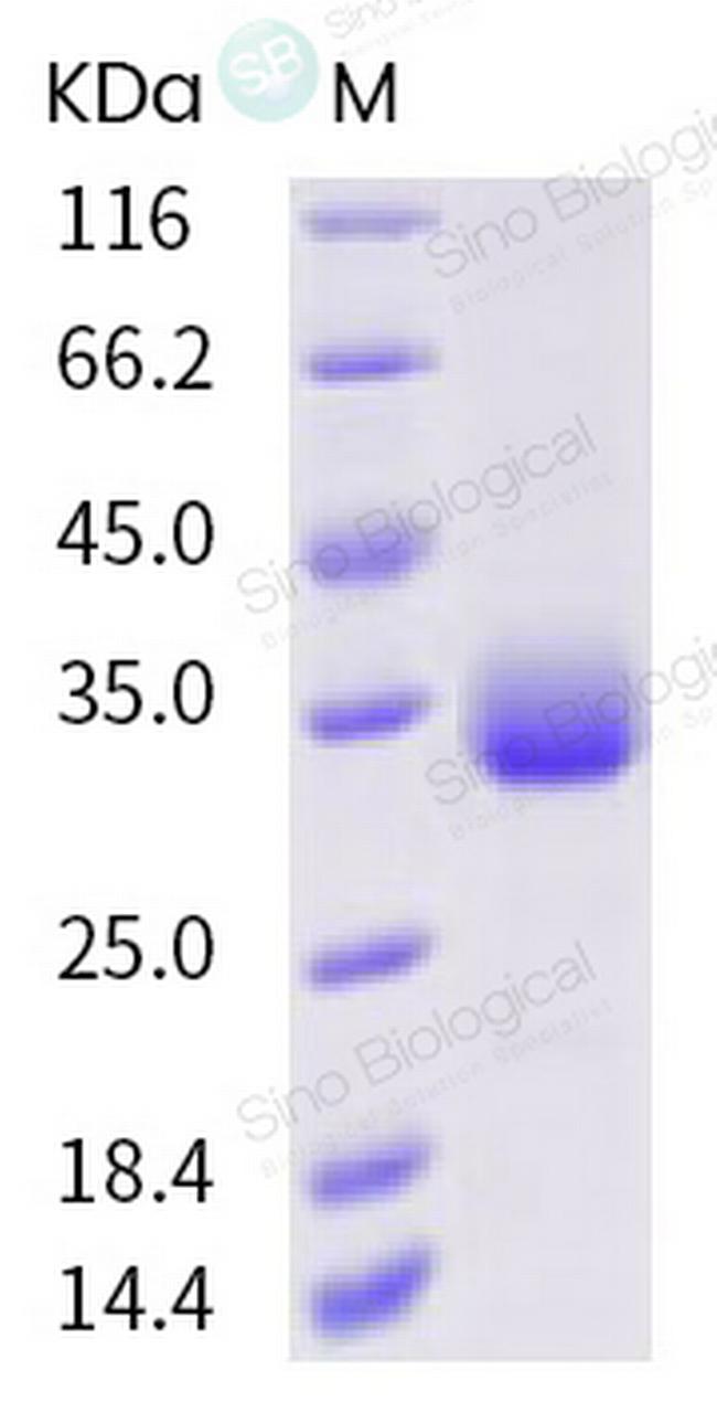 SARS-CoV-2 Spike Protein (RBD) (F342L) His-tag Protein