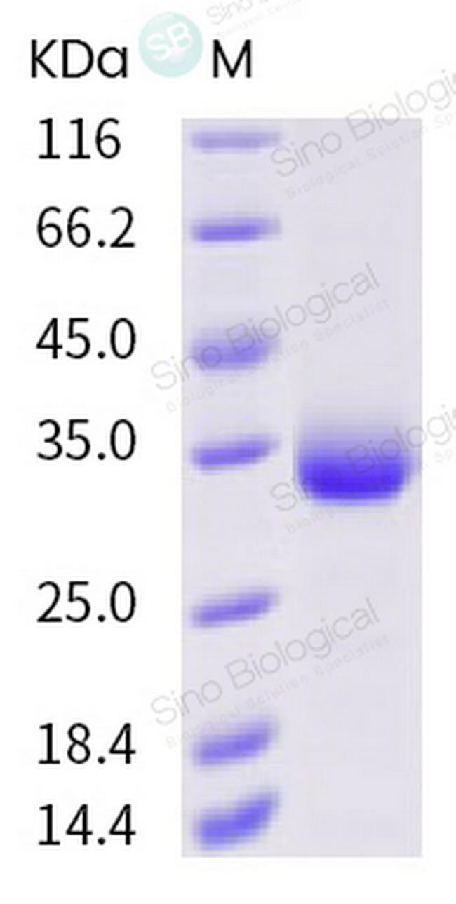 SARS-CoV-2 Spike Protein (RBD) (K458R) His-tag Protein