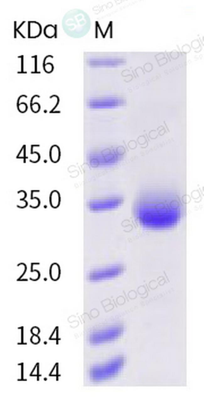 SARS-CoV-2 Spike Protein (RBD) (N354D) His-tag Protein