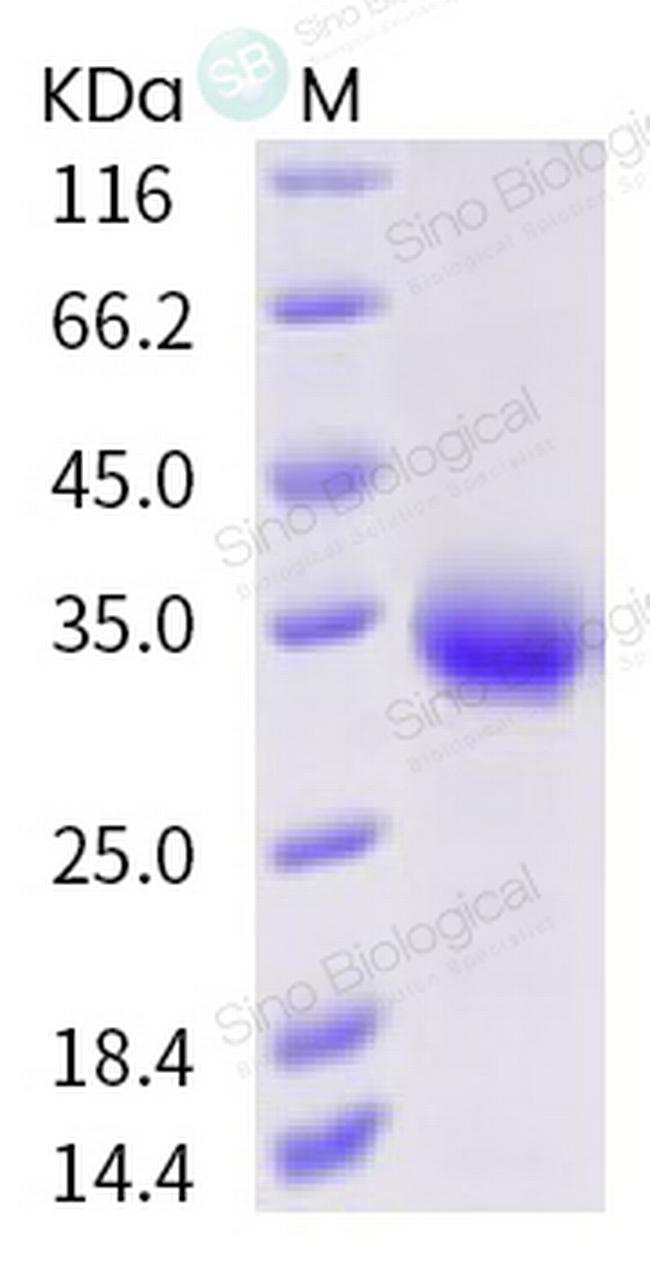 SARS-CoV-2 Spike Protein (RBD) (V367F) His-tag Protein