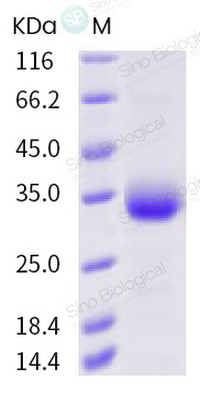 SARS-CoV-2 Spike Protein (RBD) (V483A) His-tag Protein