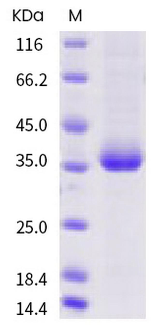 SARS-CoV-2 Spike Protein (RBD) (W436R) His-tag Protein