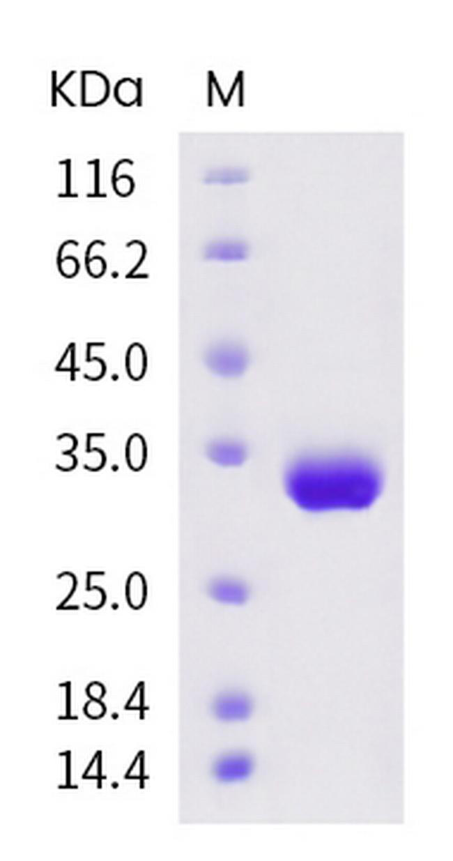 SARS-CoV-2 Spike Protein (RBD) His-tag Protein