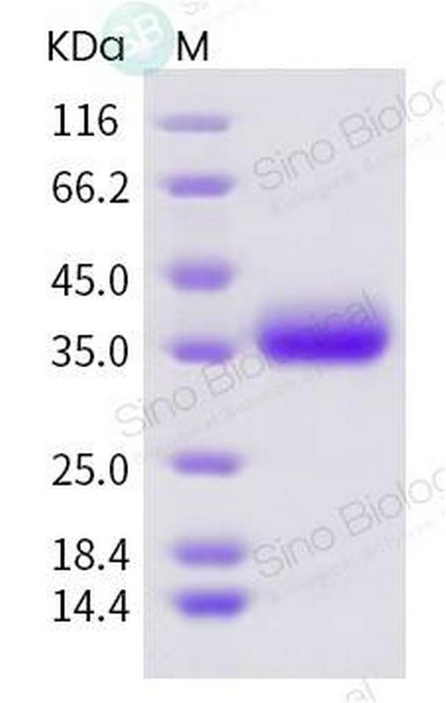 SARS-CoV-2 Spike Protein (RBD) His-tag Protein