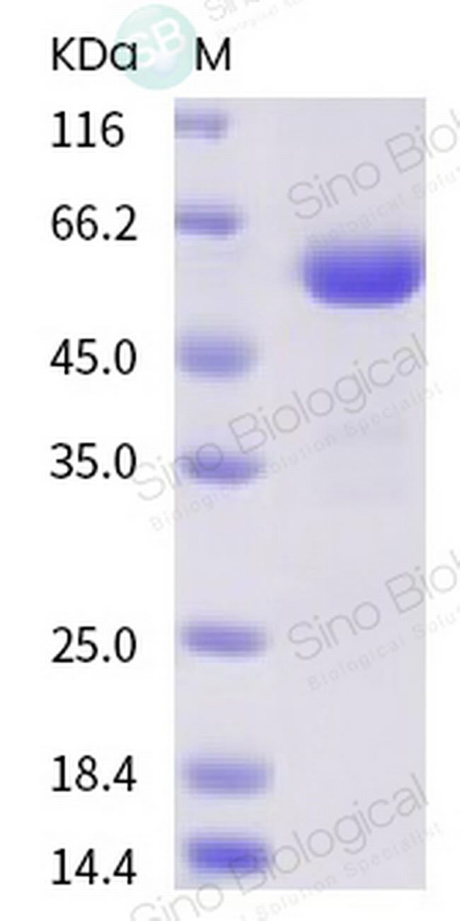 SARS-CoV-2 Spike Protein (RBD) (V367F) Fc Chimera Protein