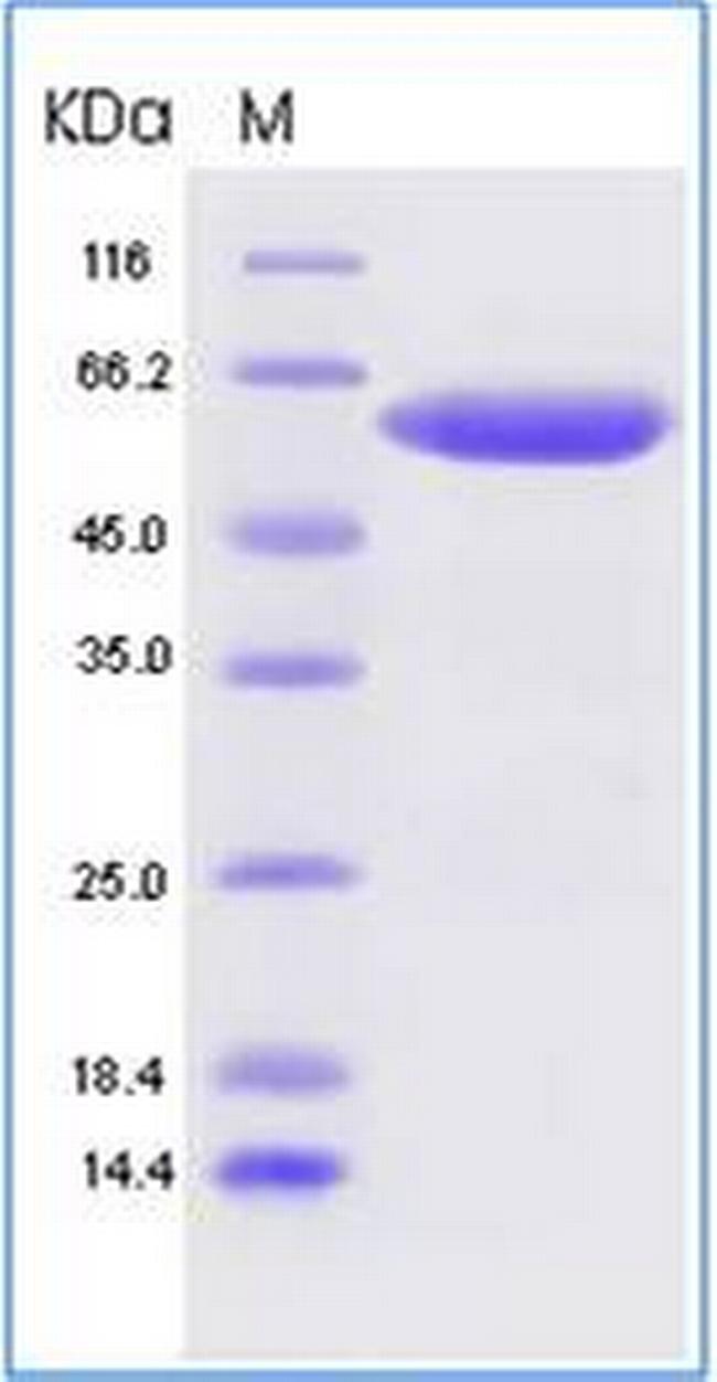 SARS-CoV-2 Spike Protein (RBD) Fc Chimera Protein