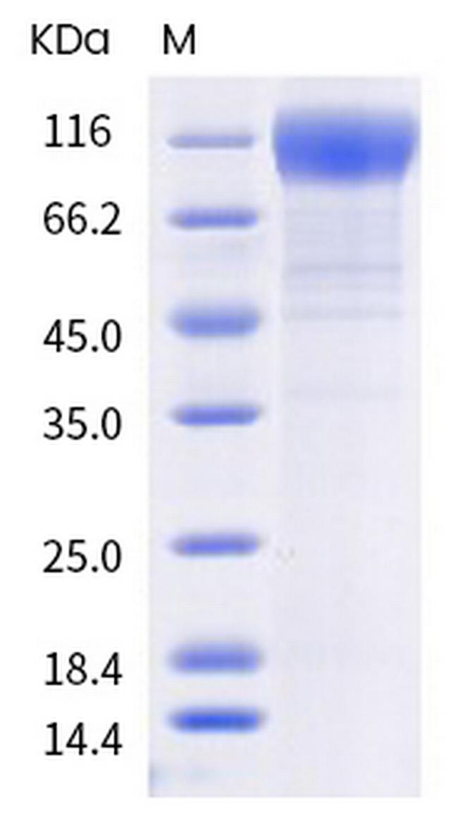 SARS-CoV-2 Spike Protein S1 (mutant) His-tag Protein