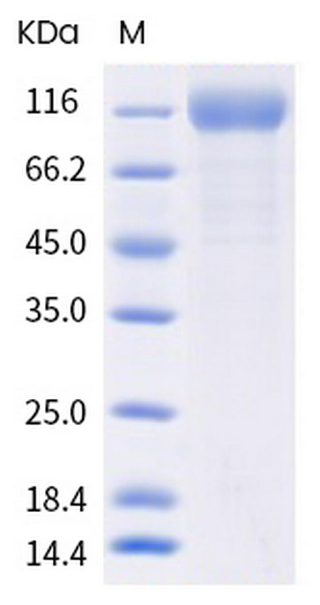 SARS-CoV-2 Spike Protein S1 (P.1) His-tag Protein