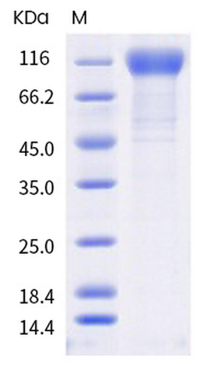 SARS-CoV-2 Spike Protein S1 (Q677H) His-tag Protein