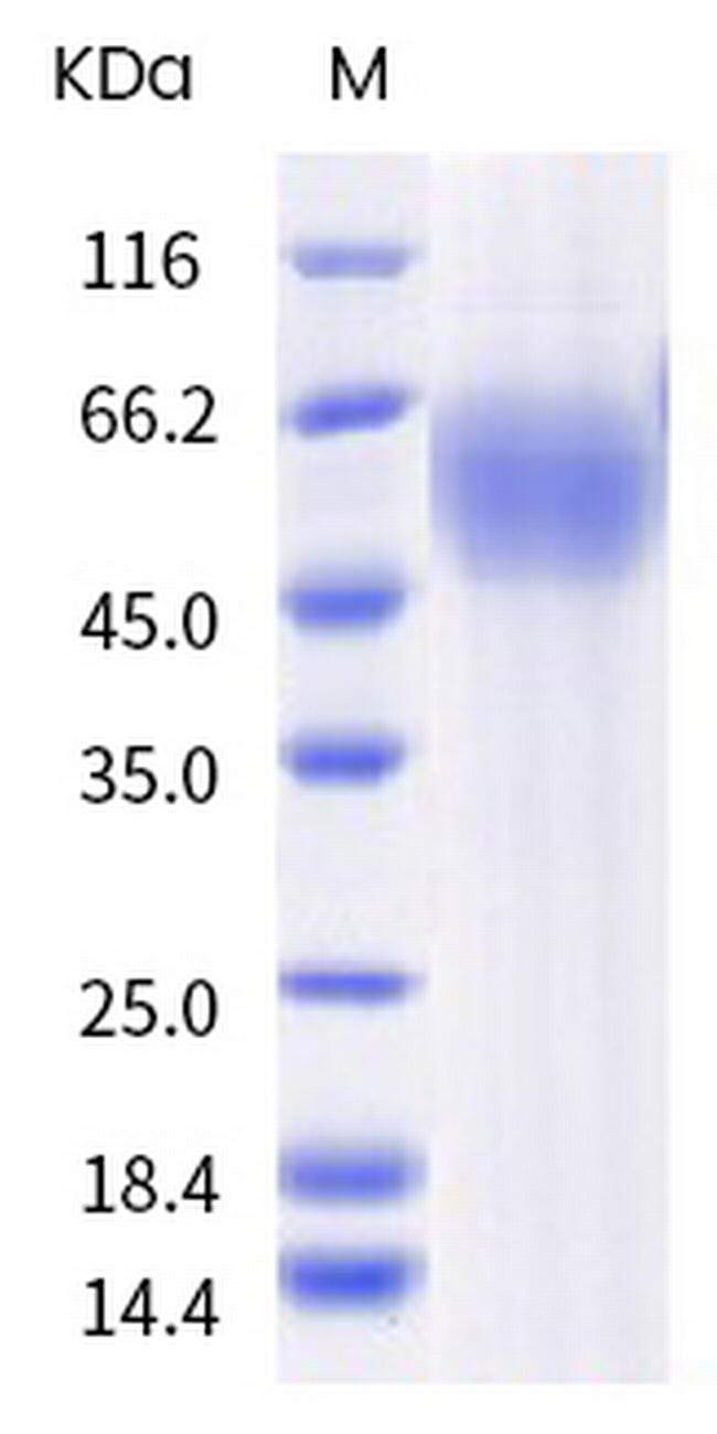 SARS-CoV-2 Spike Protein S1 NTD (B.1.351) His-tag Protein