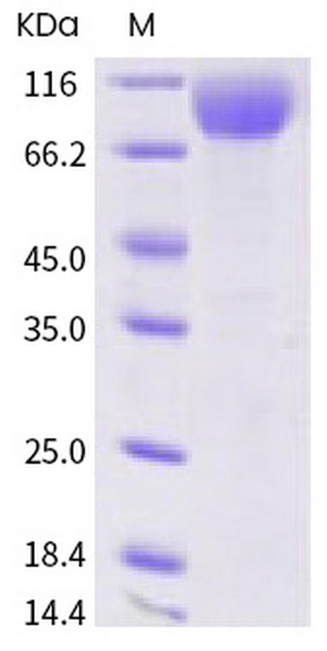 SARS-CoV-2 Spike Protein S1 Fc Chimera Avi-tag Protein